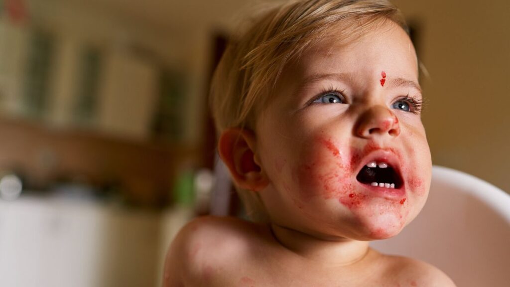 baby food allergy rash